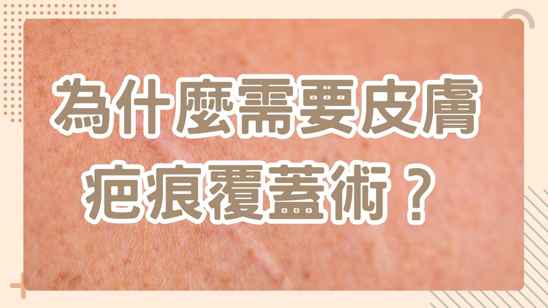 為什麼需要皮膚疤痕覆蓋術？